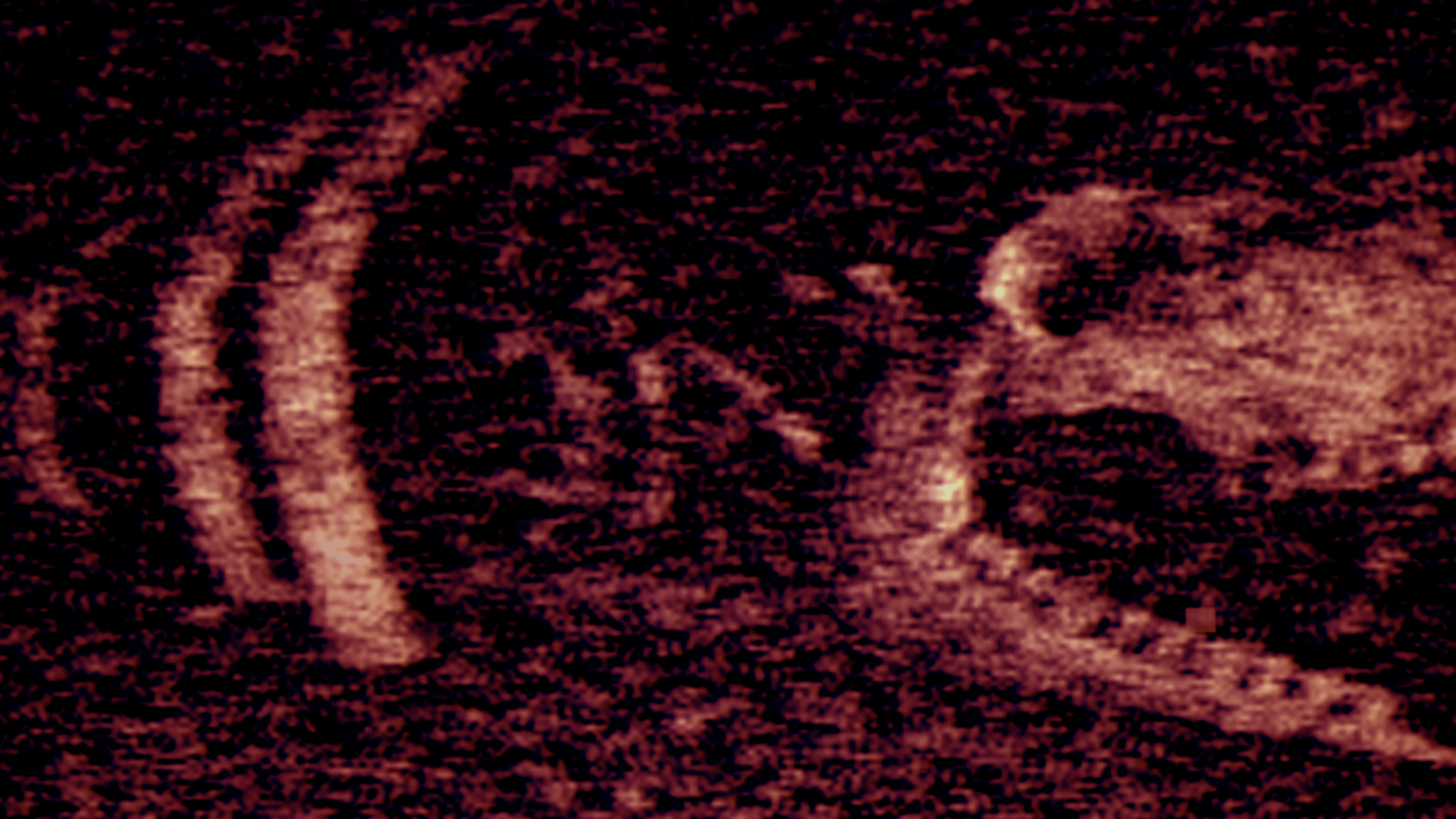 Iron Lung cover image